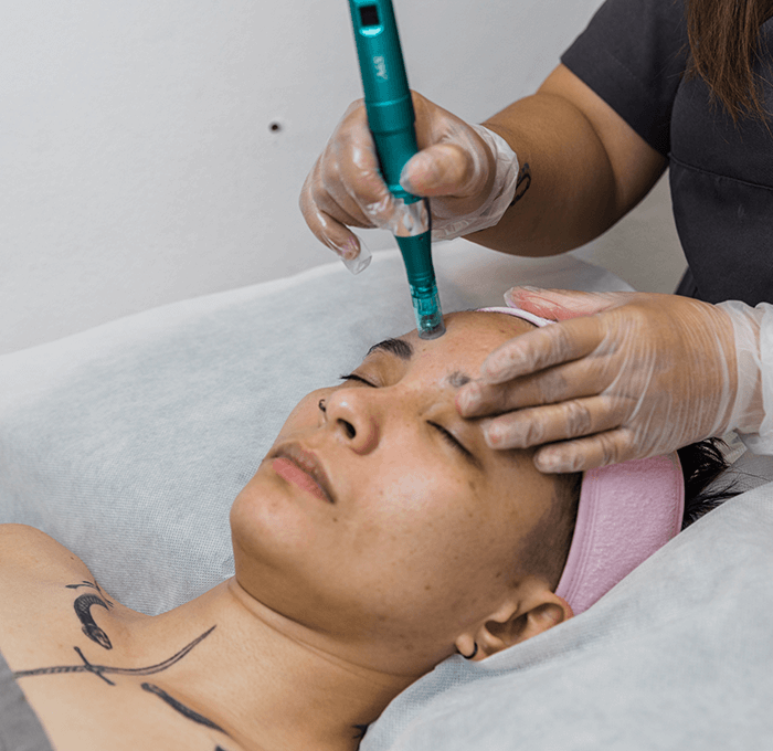 Microneedling + Facial