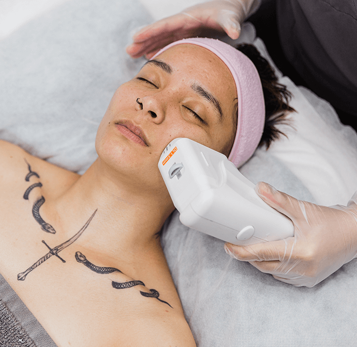 HiFu Skin Tightening