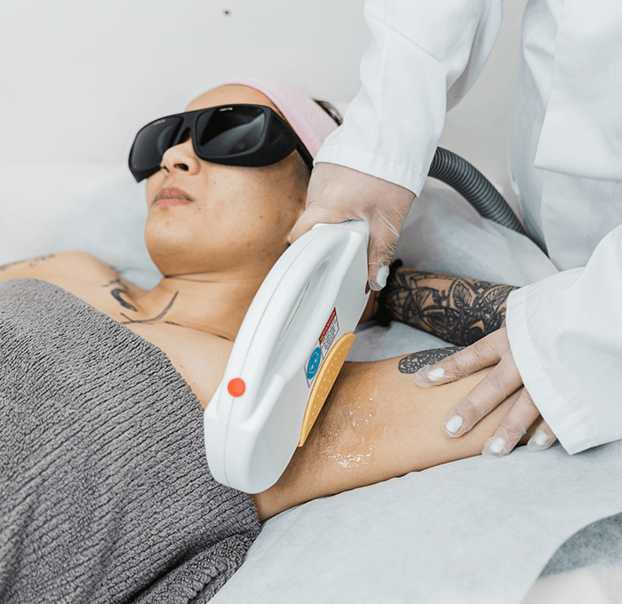 IPL Hair Laser Removal