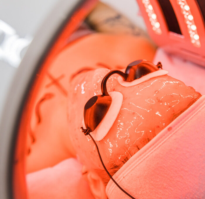 ASCE + Exosome​ + Facial