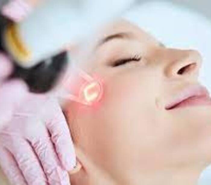 C02 Fractional Laser + Facial​