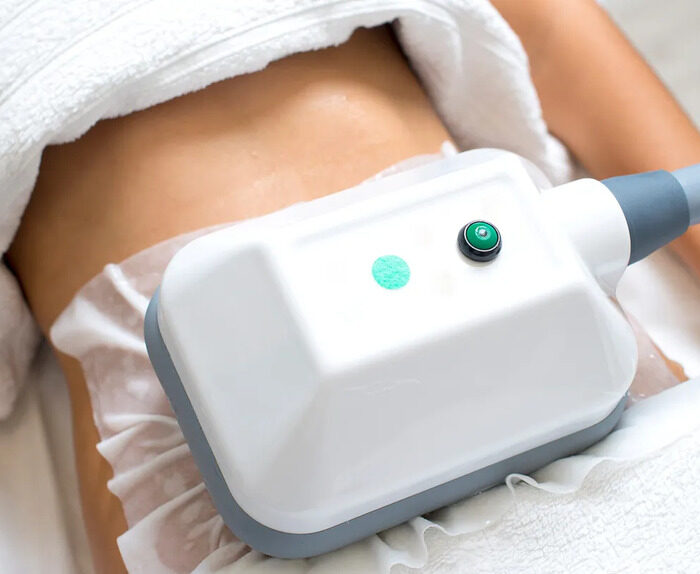 Cryolipolysis – Slimming​